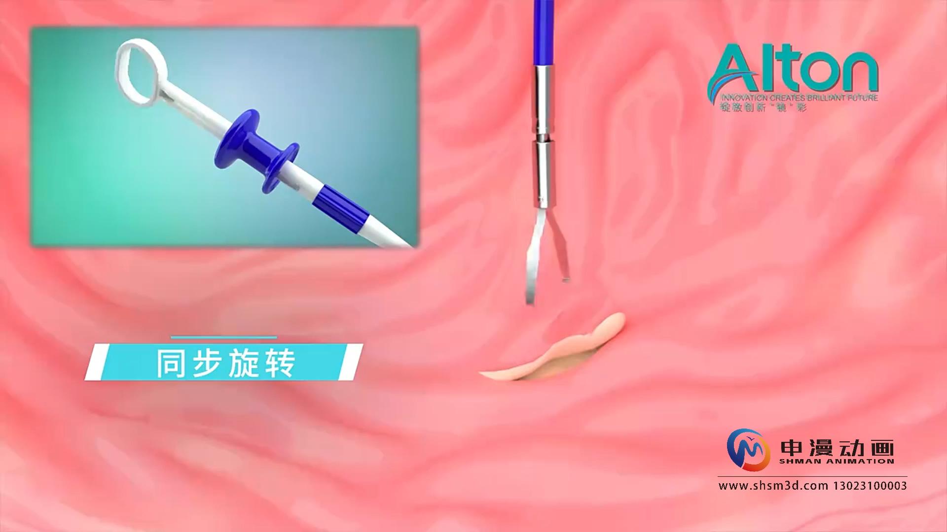 一次性使用消化道软组织夹演示动画